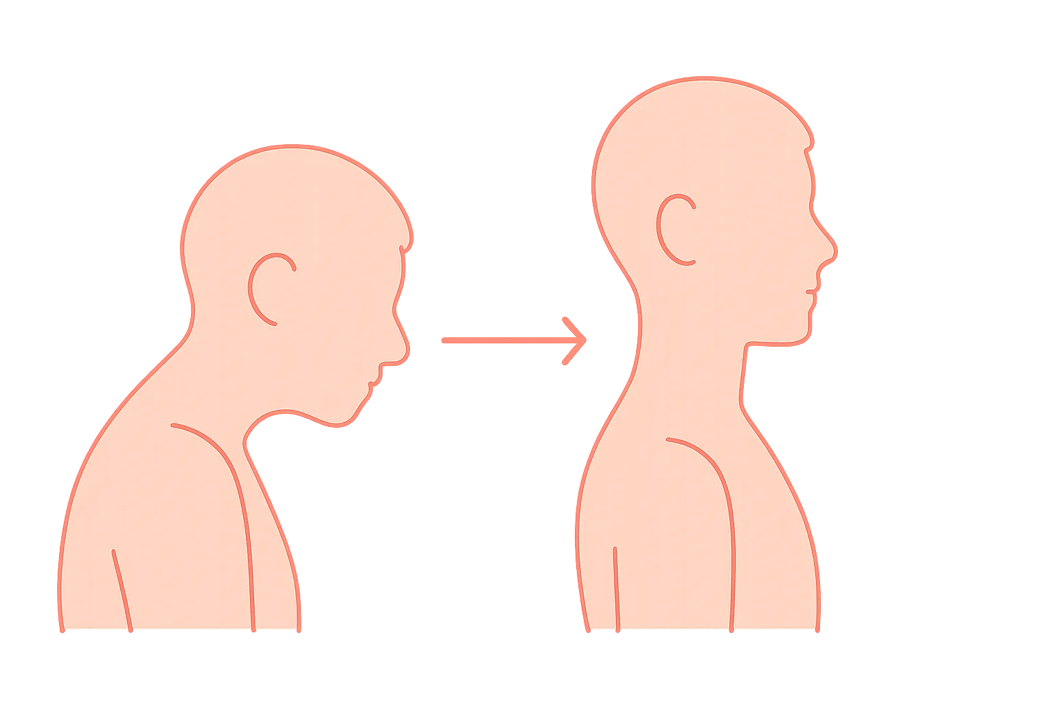Illustration of forward head posture correction